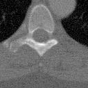 Two-step low-dose CT denoising paper figure